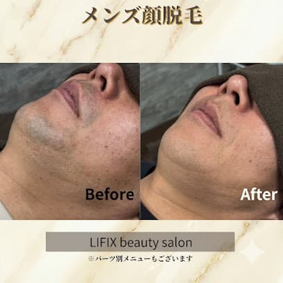 医療提携脱毛/フェイシャル専門店【LIFIX beauty salon】浜松
